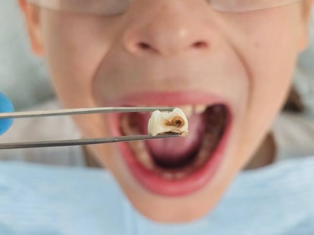 Best Emergency Care for Gum Disease in Campbellsville, KY